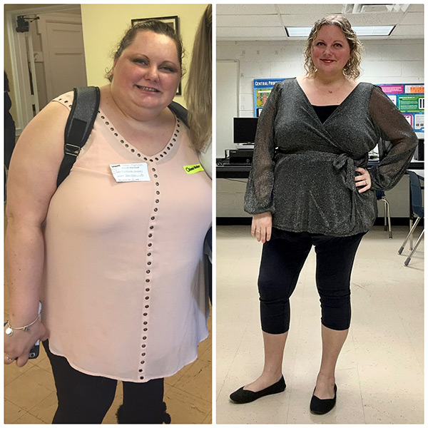 TCO 299 | Weight Loss Surgery