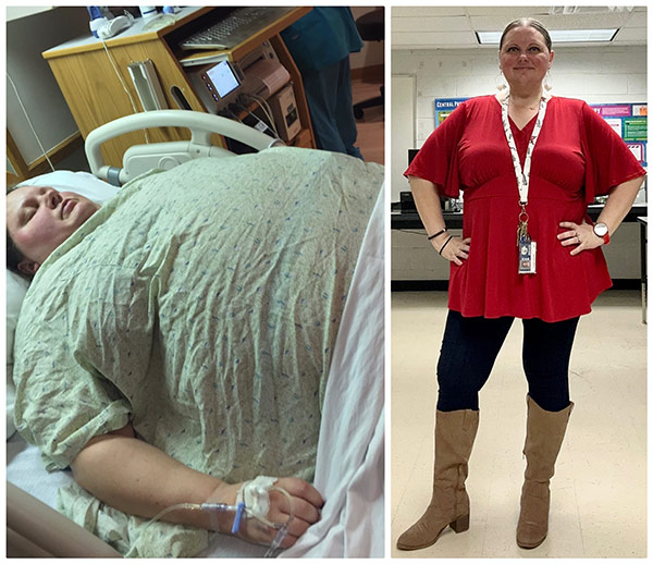 TCO 299 | Weight Loss Surgery