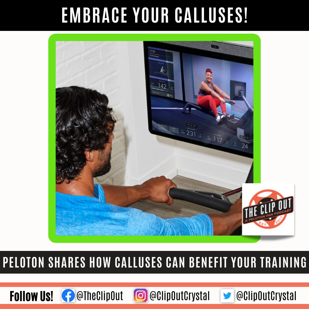 Rowing regularly leads to hand calluses. Learn how to manage