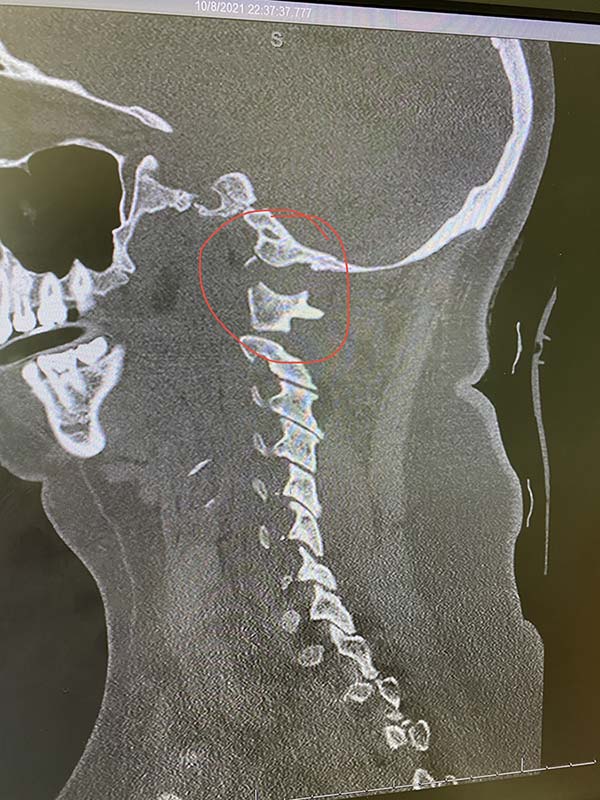 TCO 321 | Medical Issue